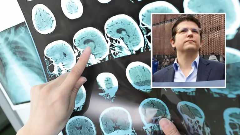 Última Actualización sobre Miguel Uribe: Optimismo en su Recuperación de Sangrado Intracerebral según Experto